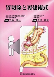 胃切除と再建術式