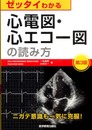 ゼッタイわかる心電図・心エコ-図の読み方