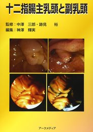 十二指腸主乳頭と副乳頭
