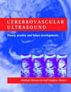 Cerebrovascular Ultrasound: Theory Practice and Future Developments