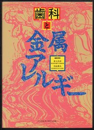 歯科と金属アレルギー