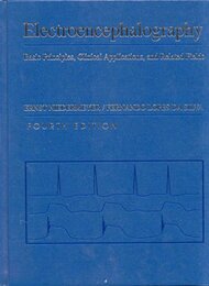Electroencephalography: Basic Principles Clinical Applications and Related Fields