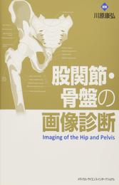 股関節・骨盤の画像診断