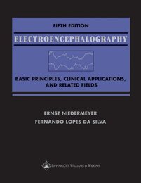 Electroencephalography