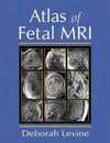 Atlas of Fetal MRI
