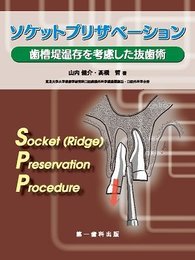 ソケットプリザベーション―歯槽堤温存を考慮した抜歯術