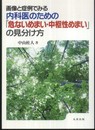 画像と症例でみる内科医のための「危ないめまい・中枢性めまい」の見分け方