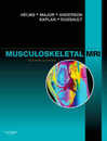 Musculoskeletal MRI 2e