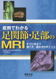 症例でわかる足関節・足部のMRI?すぐに役立つ撮り方・読み方のポイント