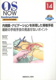 内視鏡・ナビゲーションを併用した脊椎手術?最新の手術手技の見逃せないポイント (OS NOW Instruction No.14)