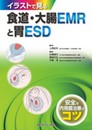 イラストで見る 食道・大腸EMRと胃ESD―安全な内視鏡治療のコツ