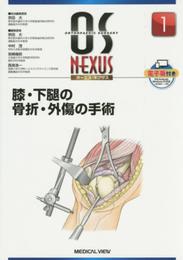 膝・下腿の骨折・外傷の手術 (OS NEXUS(電子版付き) 1)