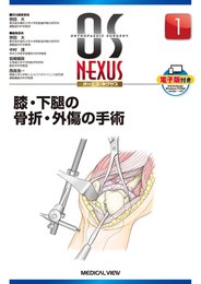 膝・下腿の骨折・外傷の手術 (OS NEXUS(電子版付き) 1)
