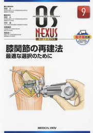 膝関節の再建法?最適な選択のために (OS NEXUS(電子版付き) 9)