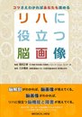 コツさえわかればあなたも読める リハに役立つ脳画像