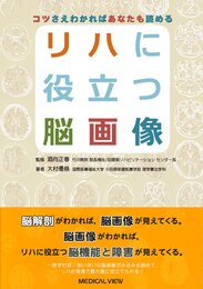コツさえわかればあなたも読める リハに役立つ脳画像