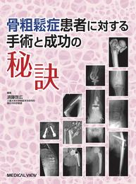 骨粗鬆症患者に対する手術と成功の秘訣