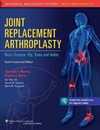 Joint Replacement Arthroplasty: Basic Science Hip Knee and Ankle (Volume 2)