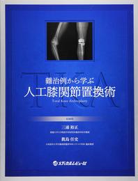 難治例から学ぶ人工膝関節置換術