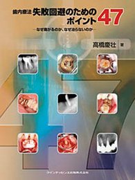 歯内療法 失敗回避のためのポイント47