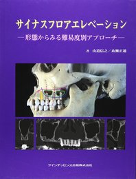 サイナスフロアエレベ-ション: 形態からみる難易度別アプロ-チ