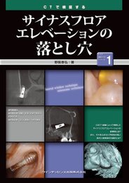 CTで検証する　サイナスフロアエレベーションの落とし穴