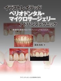 イラストレイテッド ぺリオドンタル・マイクロサージェリー アドバンステクニック (イラストレイテッドシリーズ)