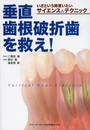 いざという時使いたいサイエンス&テクニック 垂直歯根破折歯を救え!