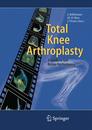 Total Knee Arthroplasty: A Guide To Get Better Performance