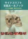 サイナスリフト実践ル-ルブック: トラブルを回避・解決するために
