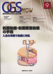 前置胎盤・前置癒着胎盤の手術?入念な準備で危機に対処 (OGS NOW 9)