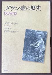 ダウン症の歴史