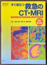すぐ役立つ救急のCT・MRI　[改訂第2版]