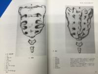 MRT仙骨無痛療法