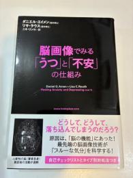 脳画像でみる「うつ」と「不安」の仕組み