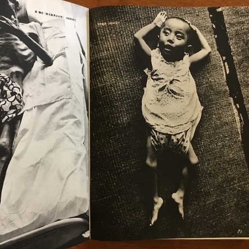 写真記録 水俣病 1960-1970(桑原史成) / 古書サンエー / 古本 写真記録 水俣病 1960-1970(桑原史成) / 古書サンエー / 古本