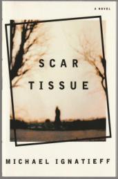 Scar tissue.