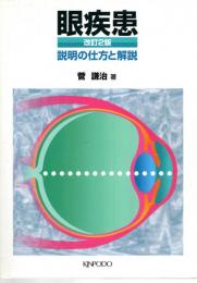 眼疾患 : 説明の仕方と解説