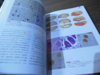 認知症 イメージングテキスト: 画像と病理から見た疾患のメカニズム