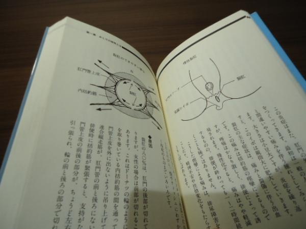 おしりの話 : 悩み解消法(宇都宮 高賢【著】) / 古書窟 揚羽堂 / 古本