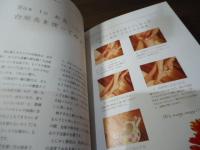 お灸女子1年生