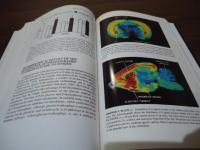 Imaging drug action in the brain
