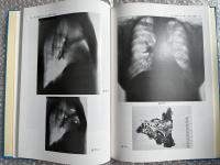 癌X線読影講座 Ⅰ・Ⅱ巻セット 石川七郎監修