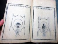 和本江戸安永4年（1775）賀川流産科医学「産論翼」乾坤2冊揃い