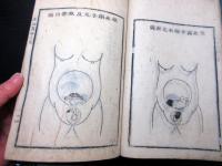 和本江戸安永4年（1775）賀川流産科医学「産論翼」乾坤2冊揃い