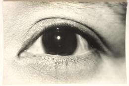 古写真「眼のクローズアップ」