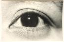 古写真「眼のクローズアップ」