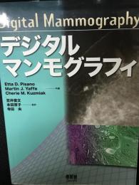 デジタルマンモグラフィ