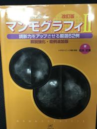 手にとるようにわかるマンモグラフィ2　改訂版.（読影力をアップさせる厳選62例 解説強化・症例追加版）