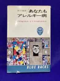あなたもアレルギー病 : なぜ起きるか,どうすればなおるか ＜ブルーバックス＞